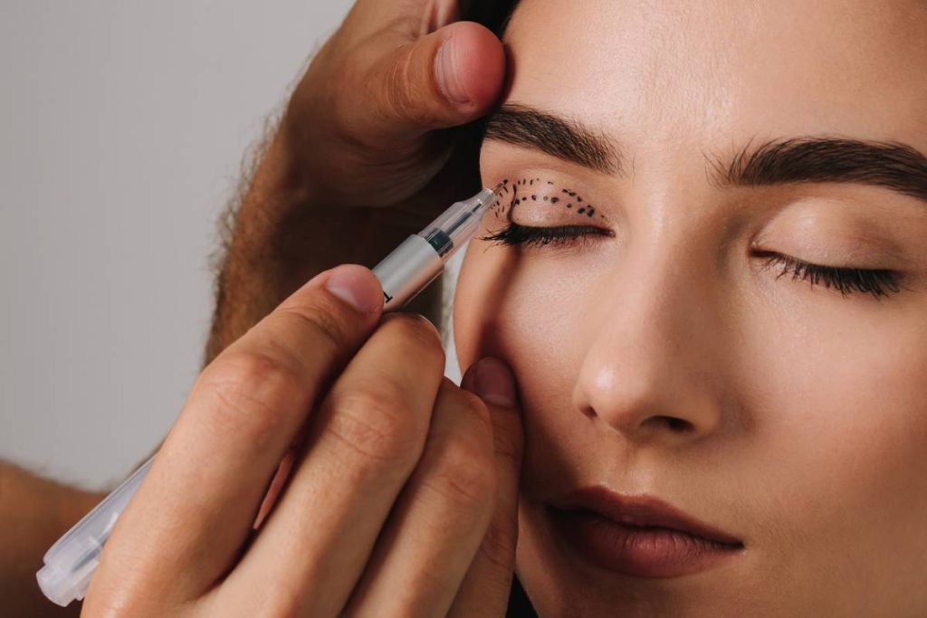 blépharoplastie Lyon chirurgie esthétique