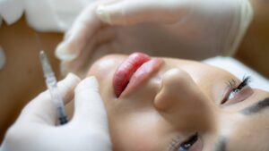 Injection acide hyaluronique
