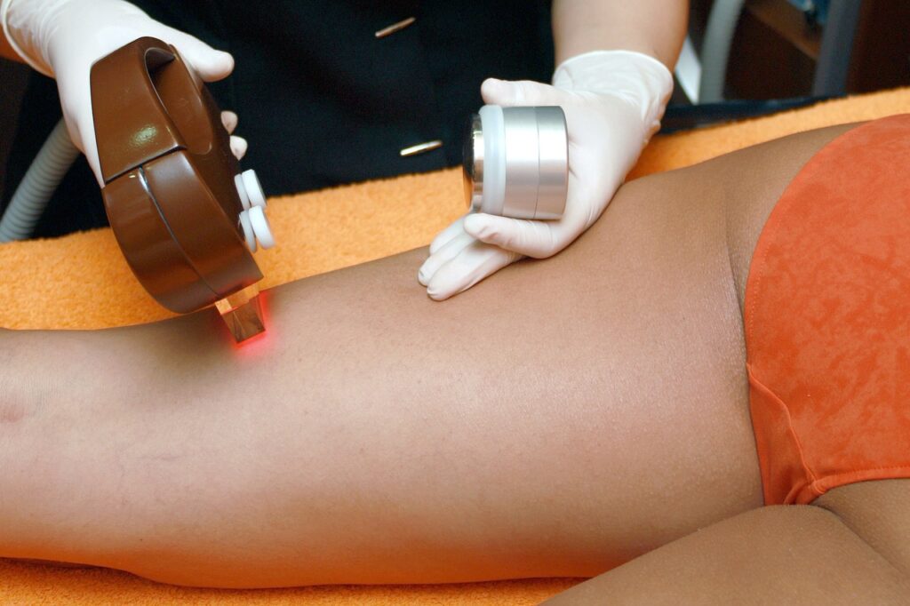 Épilation : pourquoi choisir la lumière pulsée ?
